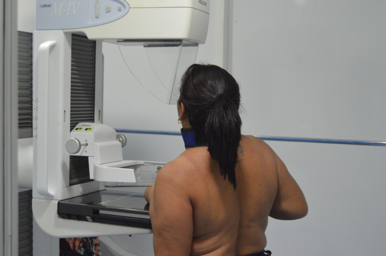 Natal: Mutirão de mamografias será realizado nos dias 18 e 19 na zona Oeste de Natal  