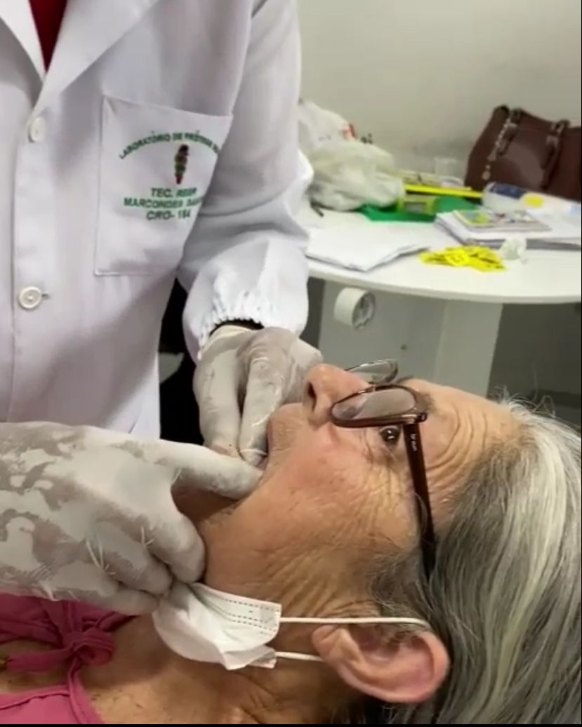 “VIVÊNCIAS DO SUS NOS RECANTOS POTIGUARES”: População de Tenente Laurentino Cruz recebe próteses dentárias através do Programa Brasil Sorridente